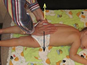 Два метода мануальной терапии по лечению растяжения связочного аппарата крестцово-подвздошного сочленения у новорождённого