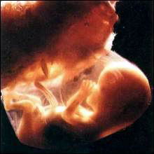 Эмбрион  11  недель